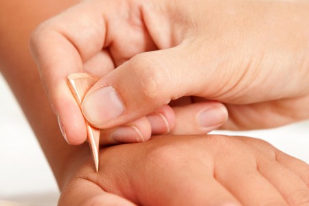 Kinderakupunktur